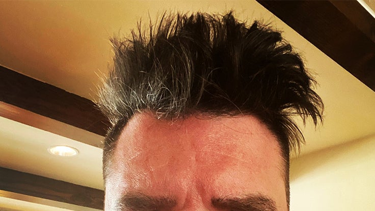 Hair