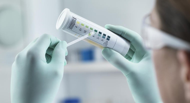 What Does It Mean When Your Urine Has a High White Cell Count